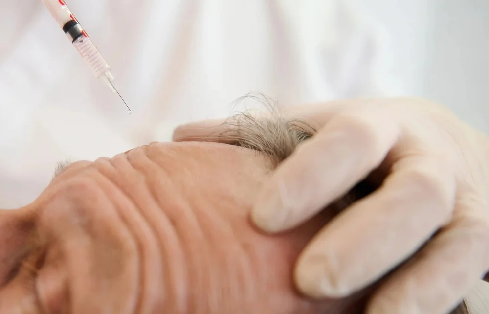 Anti-wrinkle treatment at Aesculus Clinic, New Malden