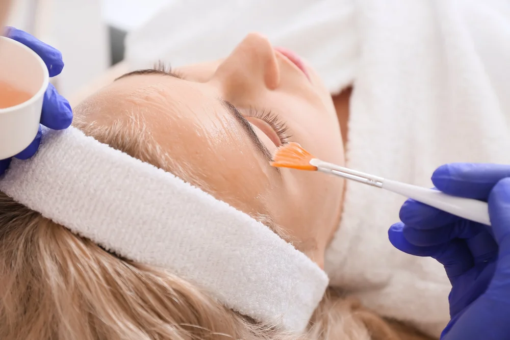 Chemical peel treatment for brighter, healthier skin