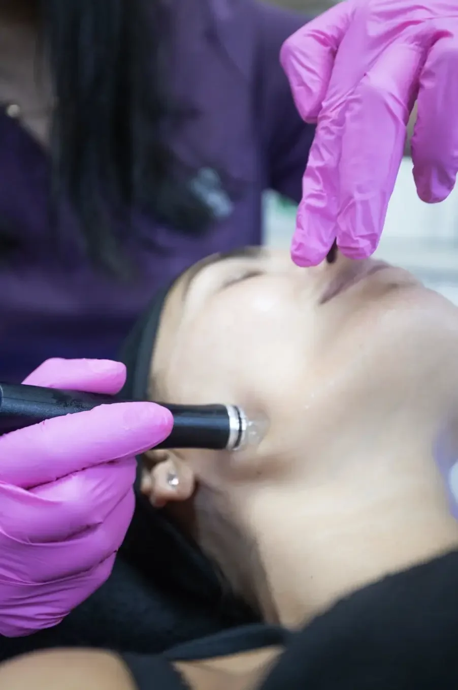 HydraFacial treatment